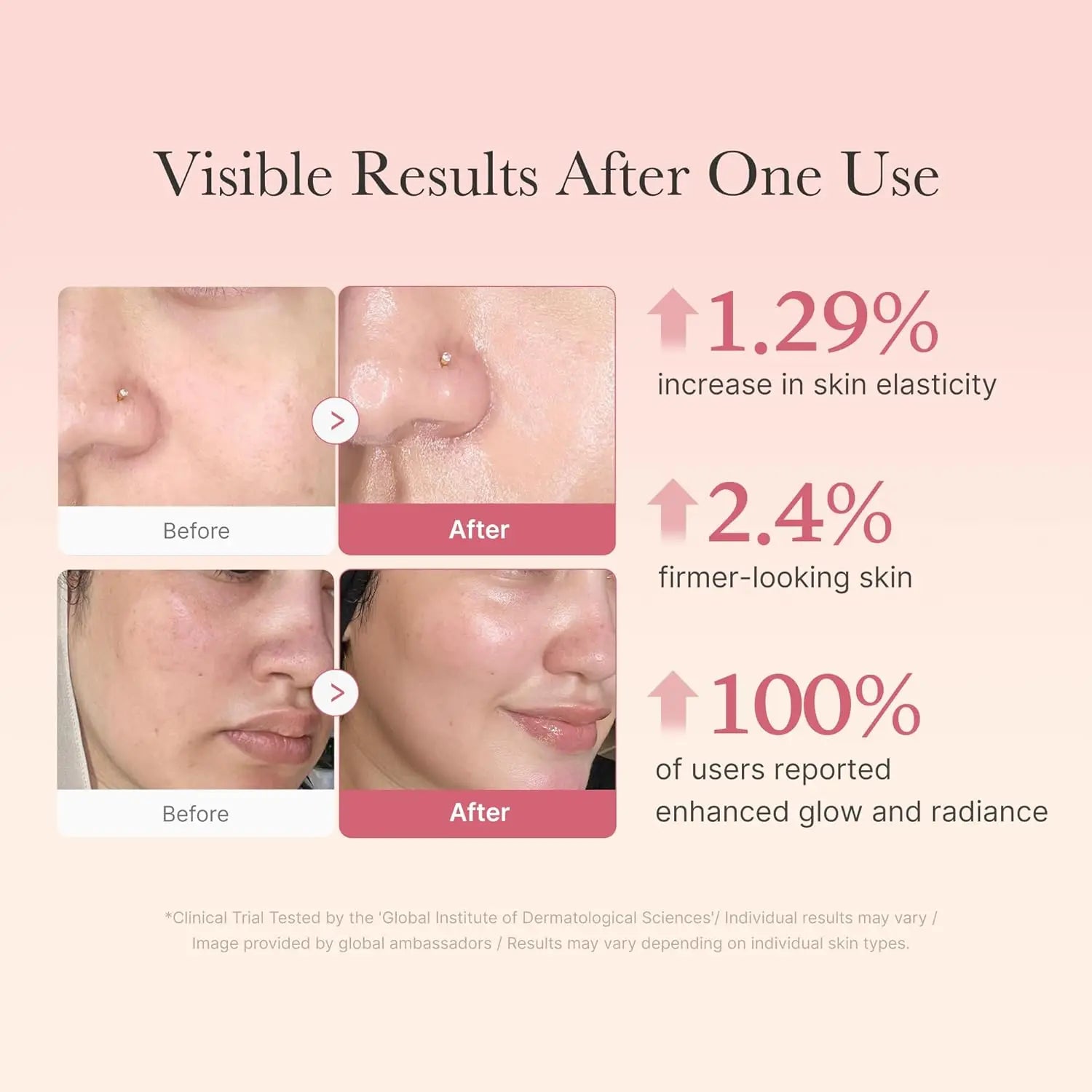 Medicube Acid Moisturizing Jelly Cream Daily Face Moisturizer Long-Lasting Hydration All Skin Types