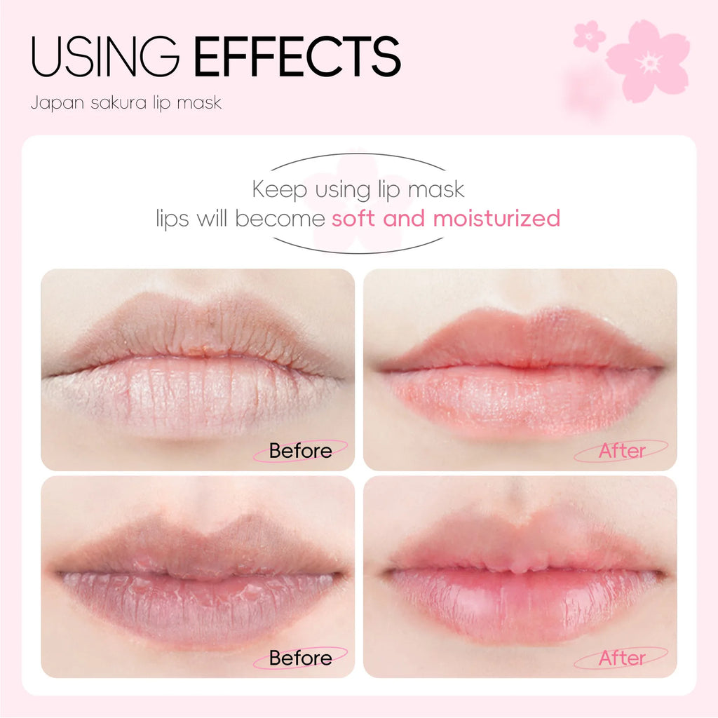 LAIKOU Overnight Lip Mask Patches 10-Pack Hydrating Repair Lighten Lip Lines Gel Pad