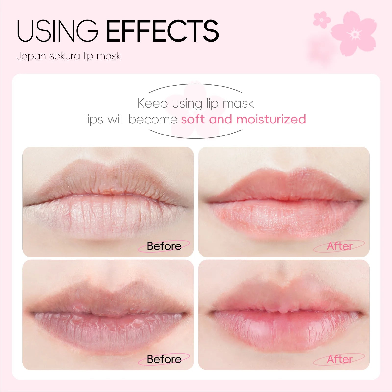 LAIKOU Overnight Lip Mask Patches 10-Pack Hydrating Repair Lighten Lip Lines Gel Pad